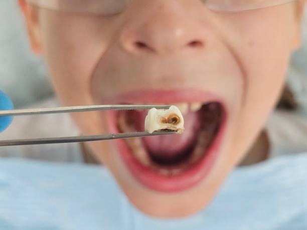 Best Emergency Dental Surgery in Williamstown, WV